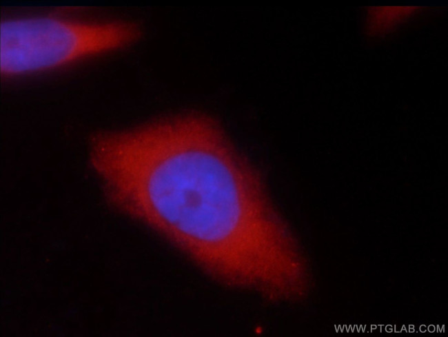 UBE4B Antibody in Immunocytochemistry (ICC/IF)