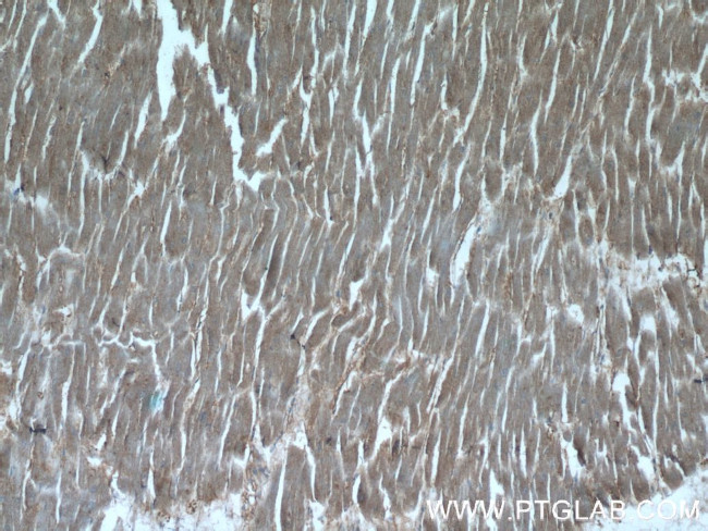 UBE4B Antibody in Immunohistochemistry (Paraffin) (IHC (P))