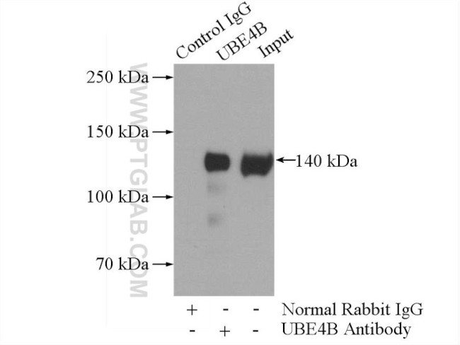 UBE4B Antibody in Immunoprecipitation (IP)