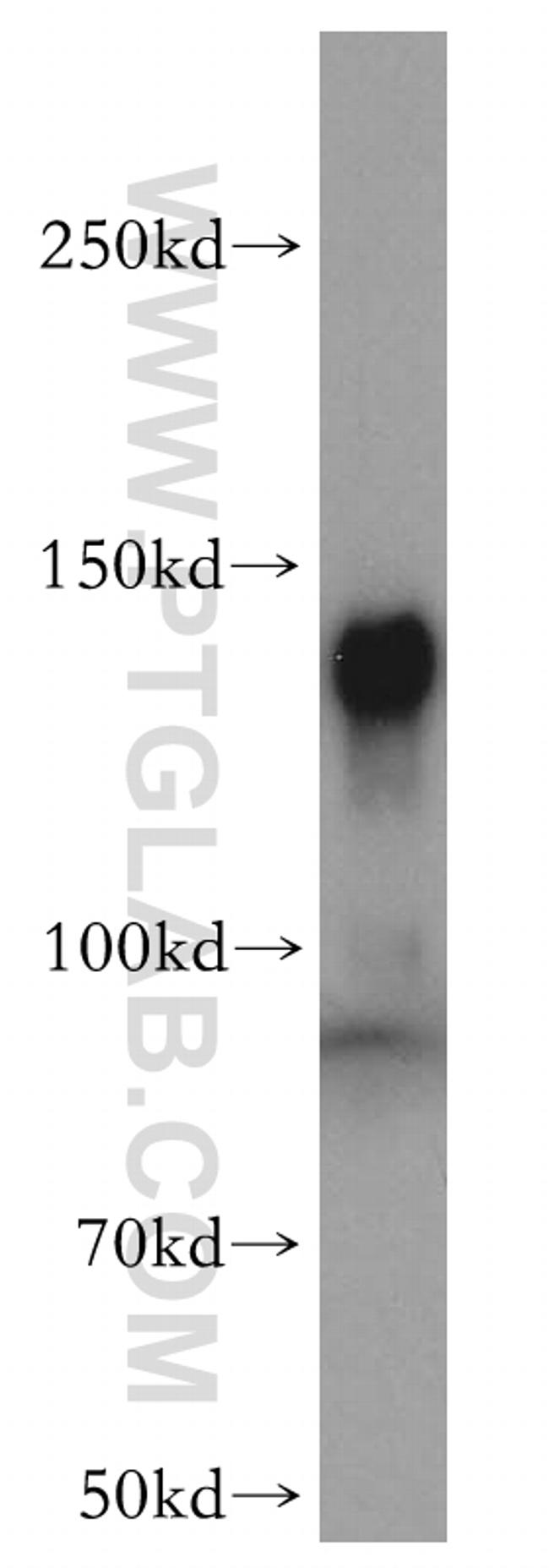 UBE4B Antibody in Western Blot (WB)