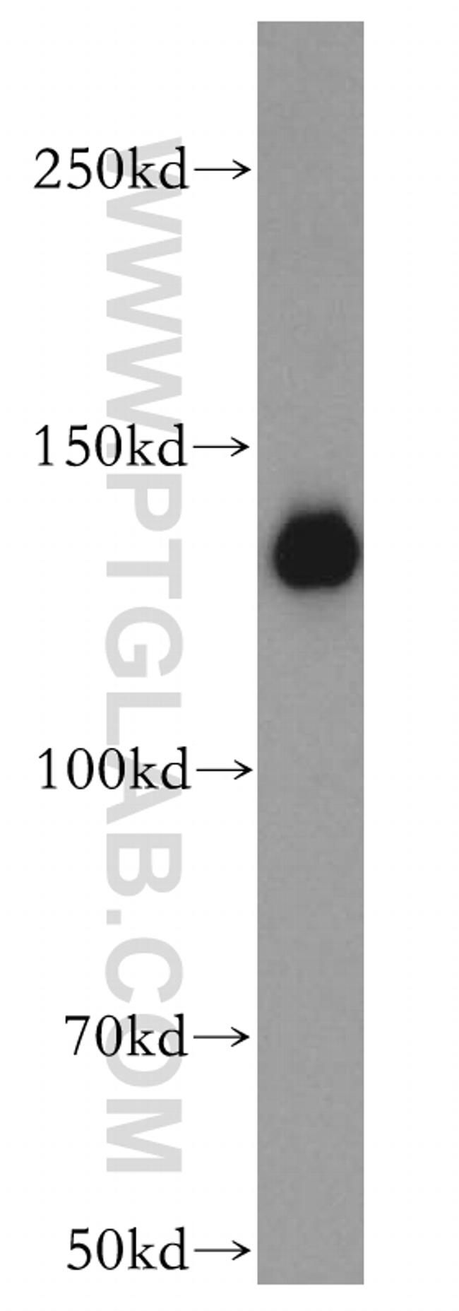 UBE4B Antibody in Western Blot (WB)