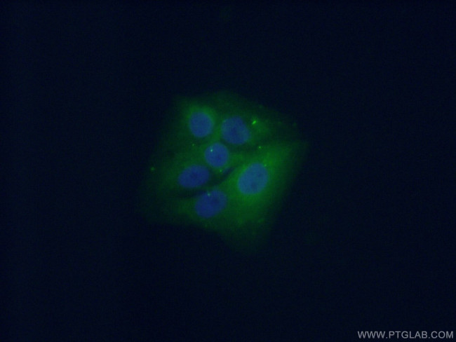 CPLX2 Antibody in Immunocytochemistry (ICC/IF)