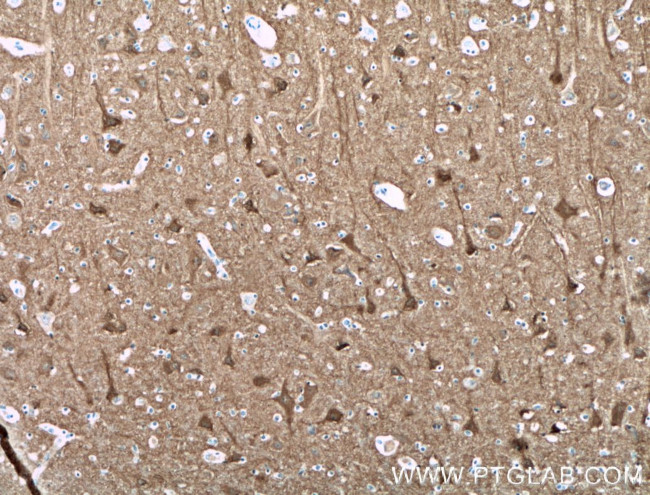 CPLX2 Antibody in Immunohistochemistry (Paraffin) (IHC (P))