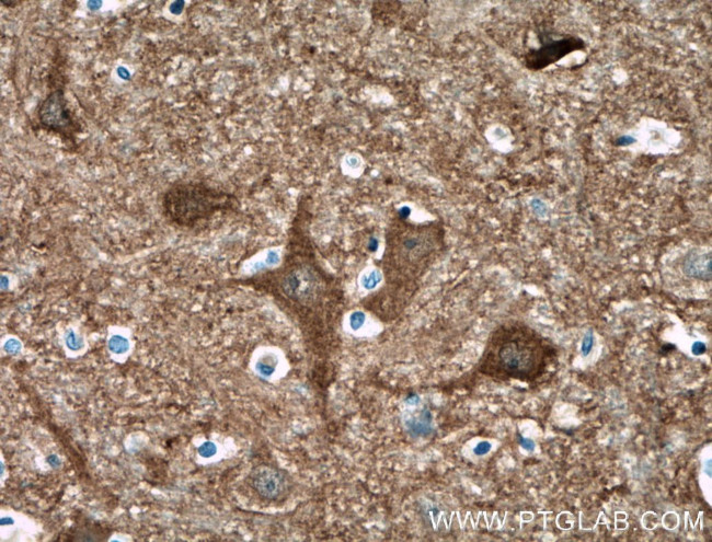 CPLX2 Antibody in Immunohistochemistry (Paraffin) (IHC (P))