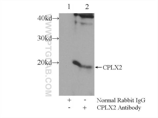 CPLX2 Antibody in Immunoprecipitation (IP)