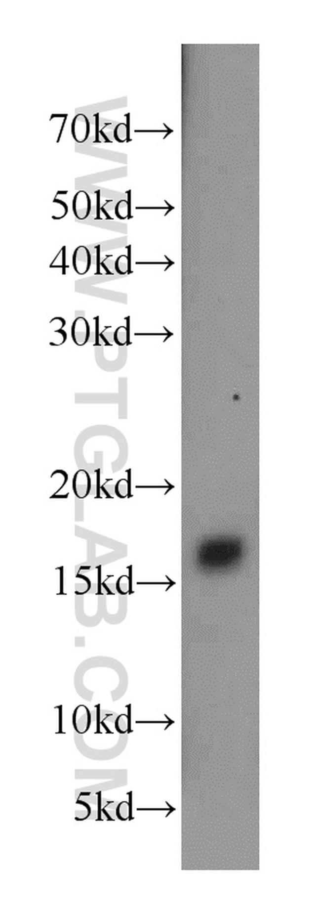 CPLX2 Antibody in Western Blot (WB)