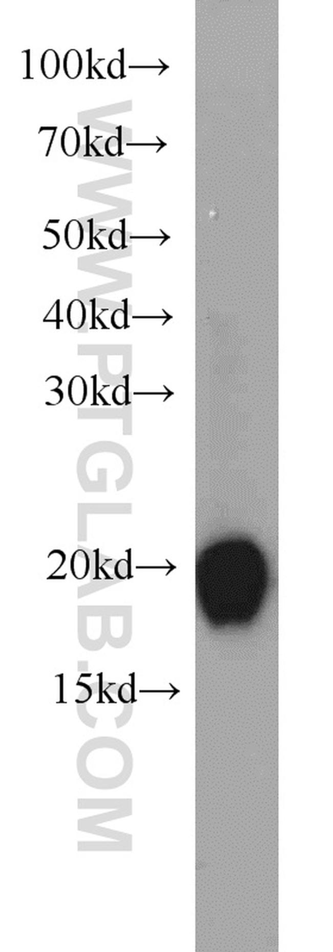 CPLX2 Antibody in Western Blot (WB)