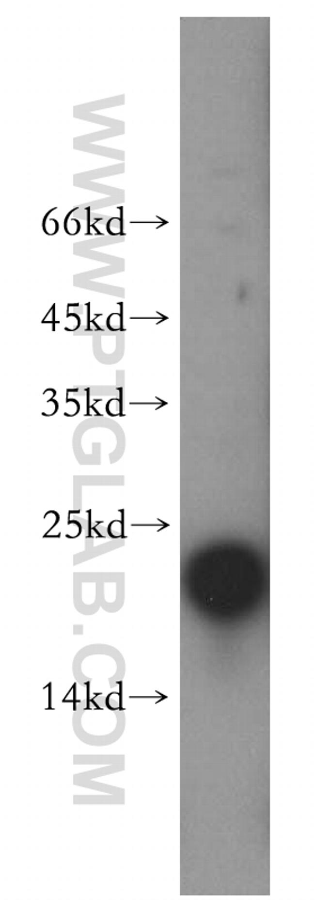 CPLX2 Antibody in Western Blot (WB)