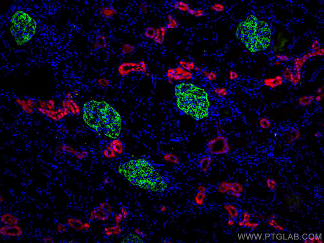 Podocalyxin Antibody in Immunohistochemistry (PFA fixed) (IHC (PFA))