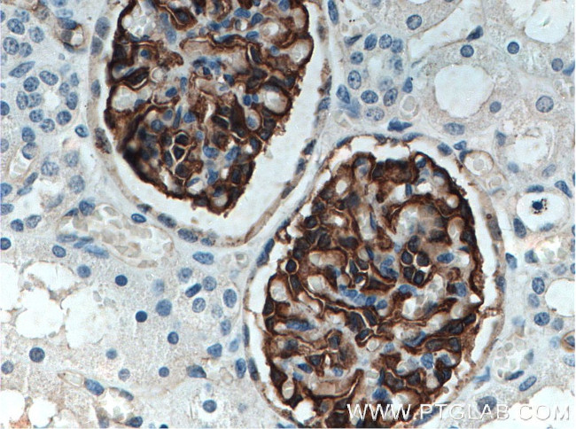 Podocalyxin Antibody in Immunohistochemistry (Paraffin) (IHC (P))