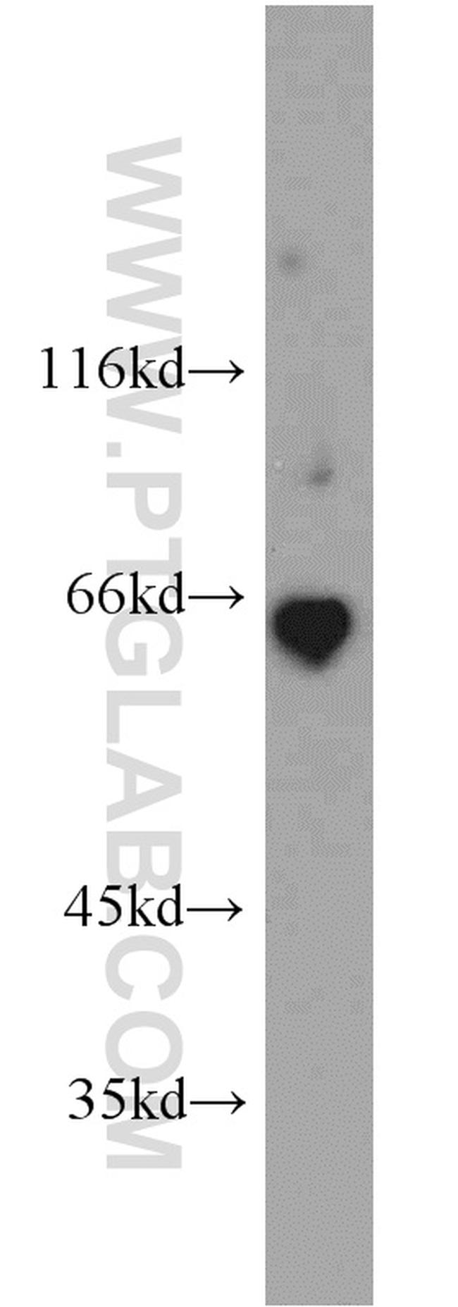 Podocalyxin Antibody in Western Blot (WB)