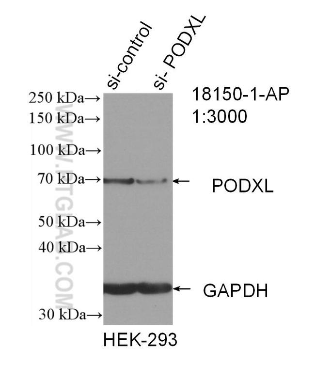 Podocalyxin Antibody in Western Blot (WB)