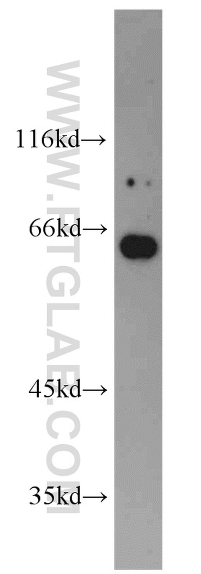 Podocalyxin Antibody in Western Blot (WB)