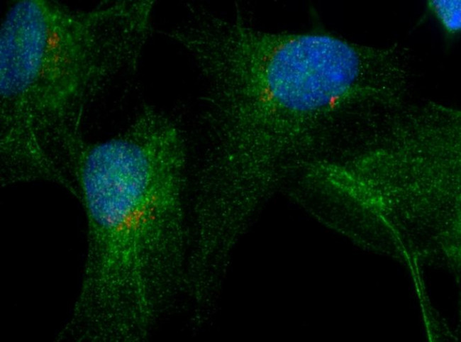 RAB9B Antibody in Immunocytochemistry (ICC/IF)