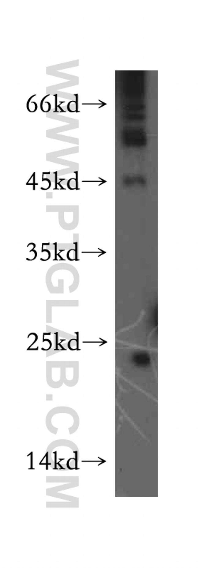 RAB9B Antibody in Western Blot (WB)