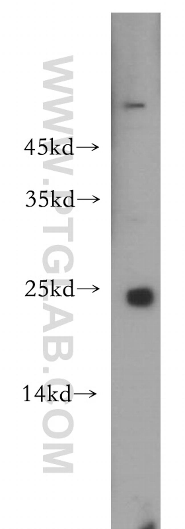 RAB9B Antibody in Western Blot (WB)