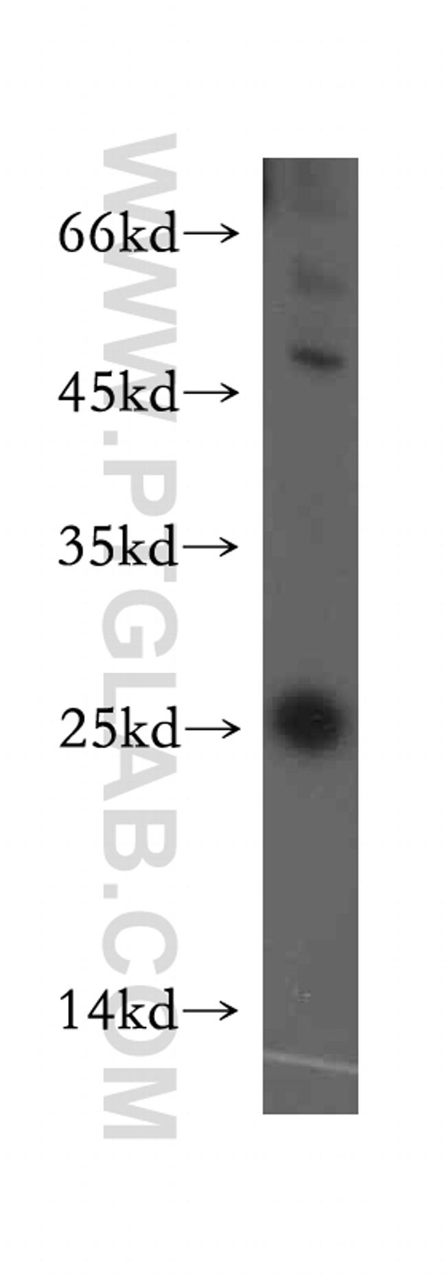 RAB9B Antibody in Western Blot (WB)