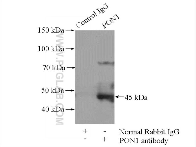 PON1 Antibody in Immunoprecipitation (IP)