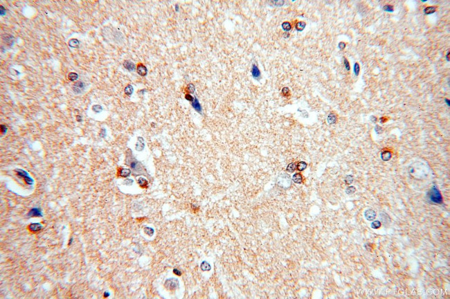 FAM118B Antibody in Immunohistochemistry (Paraffin) (IHC (P))