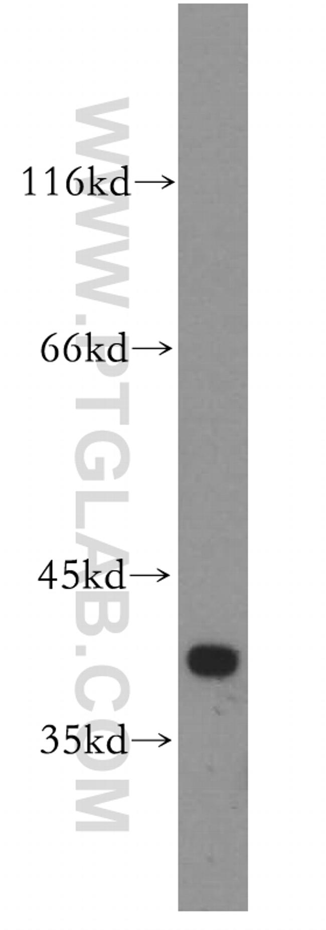 FAM118B Antibody in Western Blot (WB)