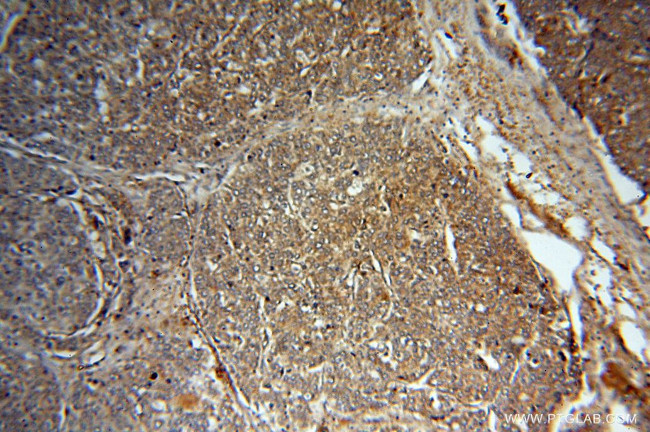 MMP13 Antibody in Immunohistochemistry (Paraffin) (IHC (P))