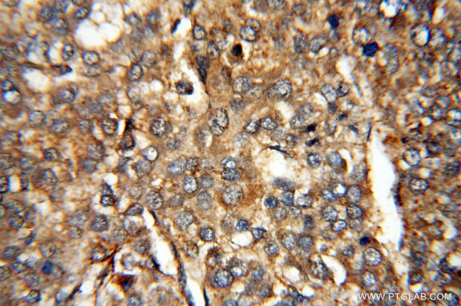 MMP13 Antibody in Immunohistochemistry (Paraffin) (IHC (P))