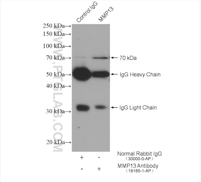 MMP13 Antibody in Immunoprecipitation (IP)
