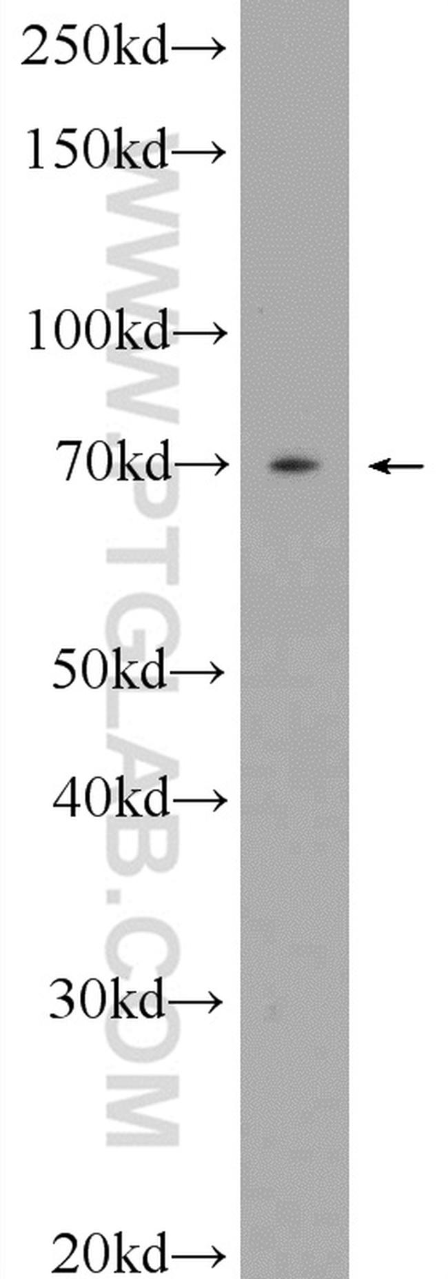 MMP13 Antibody in Western Blot (WB)