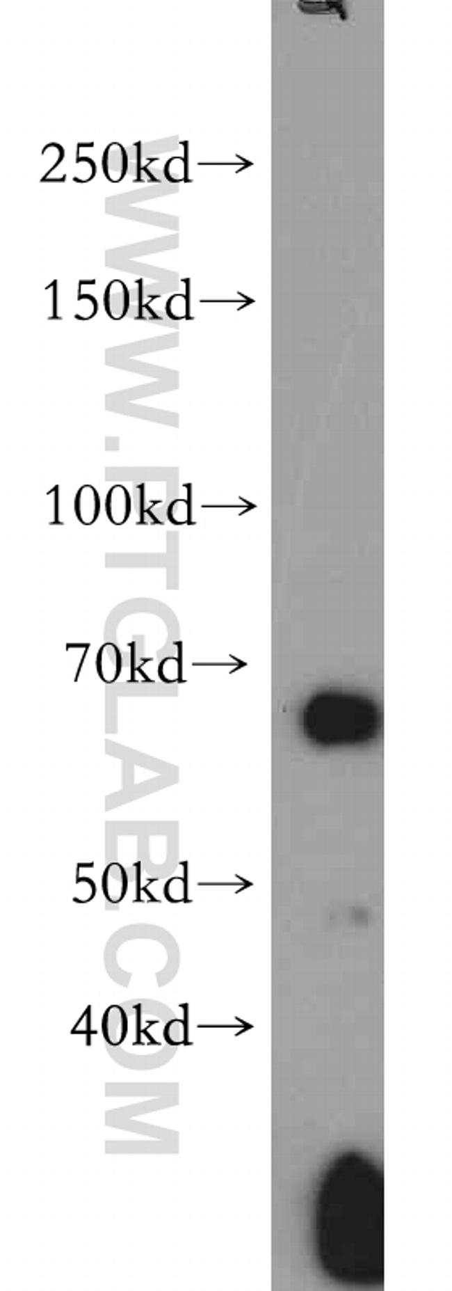 AMPK alpha 2 Antibody in Western Blot (WB)