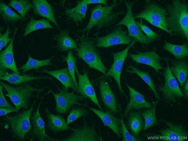 FGF5 Antibody in Immunocytochemistry (ICC/IF)