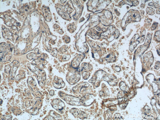 FGF5 Antibody in Immunohistochemistry (Paraffin) (IHC (P))