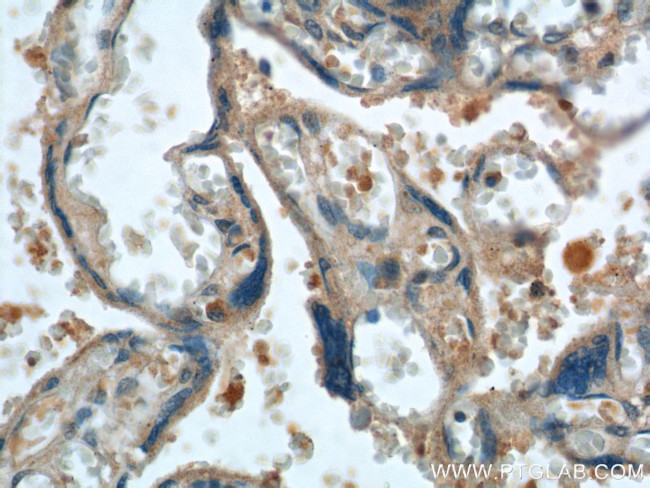 FGF5 Antibody in Immunohistochemistry (Paraffin) (IHC (P))