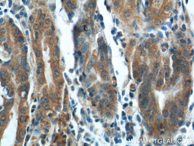 FGF5 Antibody in Immunohistochemistry (Paraffin) (IHC (P))