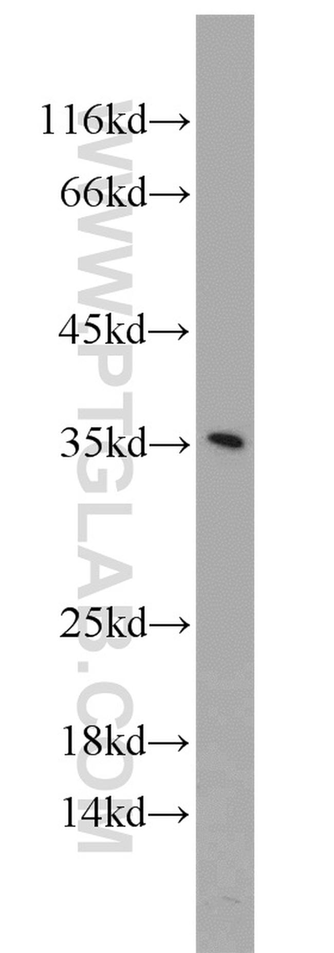 FGF5 Antibody in Western Blot (WB)