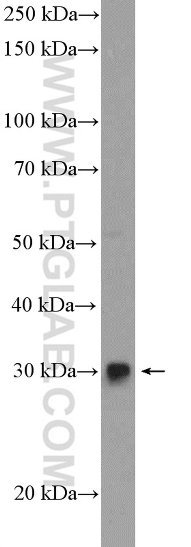 FGF5 Antibody in Western Blot (WB)