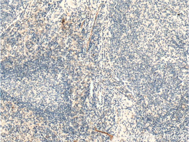 CLEC4G Antibody in Immunohistochemistry (Paraffin) (IHC (P))