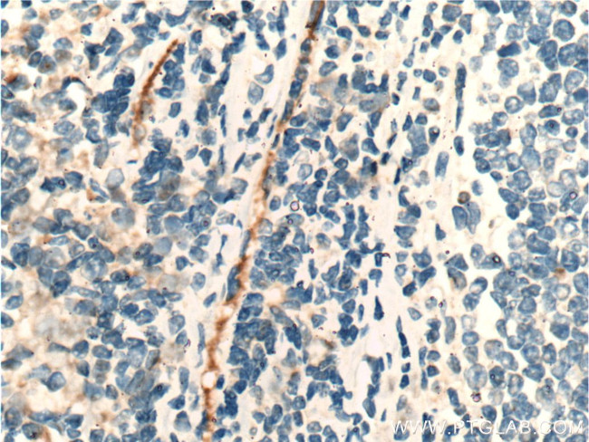 CLEC4G Antibody in Immunohistochemistry (Paraffin) (IHC (P))