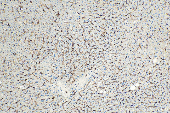 CLEC4G Antibody in Immunohistochemistry (Paraffin) (IHC (P))