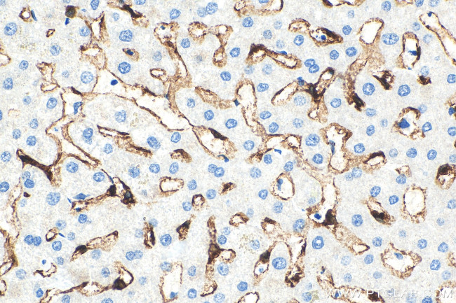 CLEC4G Antibody in Immunohistochemistry (Paraffin) (IHC (P))