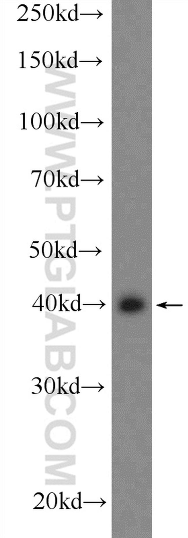 CLEC4G Antibody in Western Blot (WB)