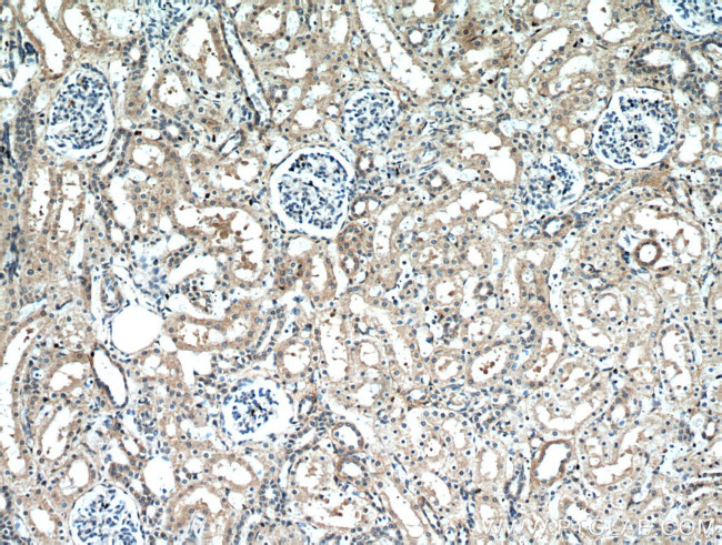 Frizzled 10 Antibody in Immunohistochemistry (Paraffin) (IHC (P))