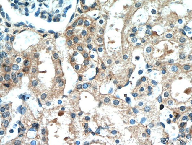 Frizzled 10 Antibody in Immunohistochemistry (Paraffin) (IHC (P))