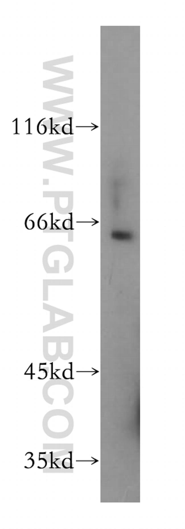 Frizzled 10 Antibody in Western Blot (WB)