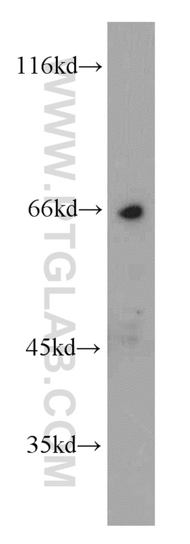 Frizzled 10 Antibody in Western Blot (WB)