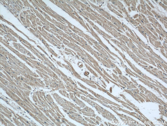 AIP/ARA9 Antibody in Immunohistochemistry (Paraffin) (IHC (P))