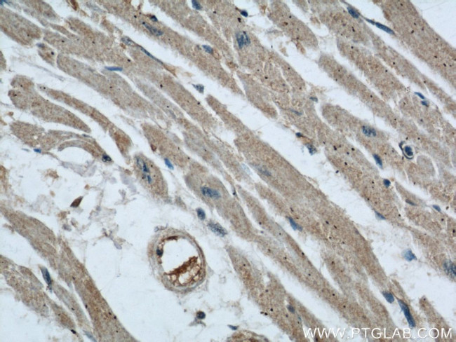 AIP/ARA9 Antibody in Immunohistochemistry (Paraffin) (IHC (P))