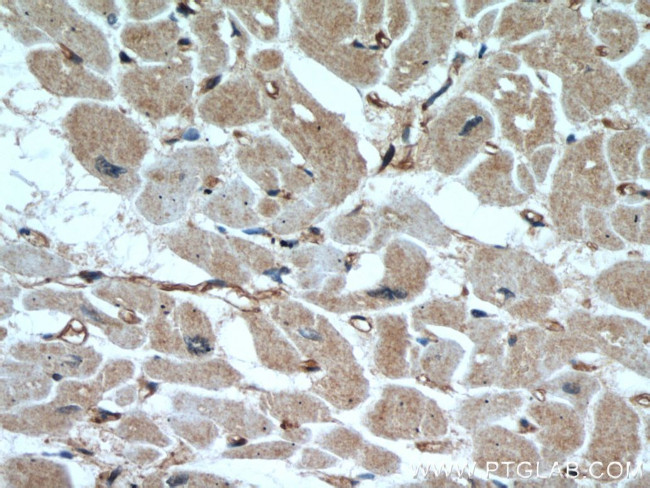 AIP/ARA9 Antibody in Immunohistochemistry (Paraffin) (IHC (P))