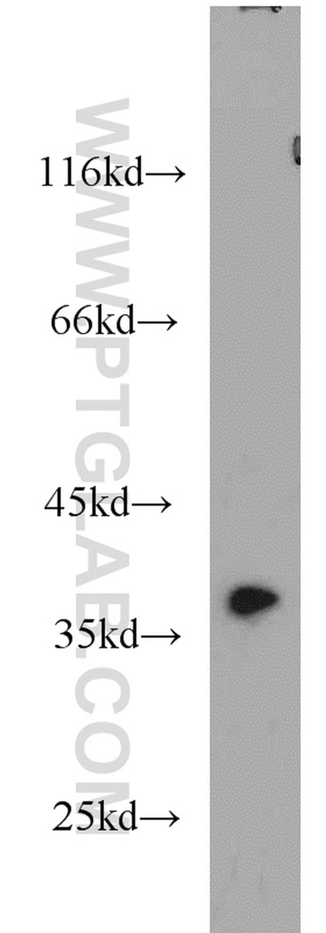 AIP/ARA9 Antibody in Western Blot (WB)