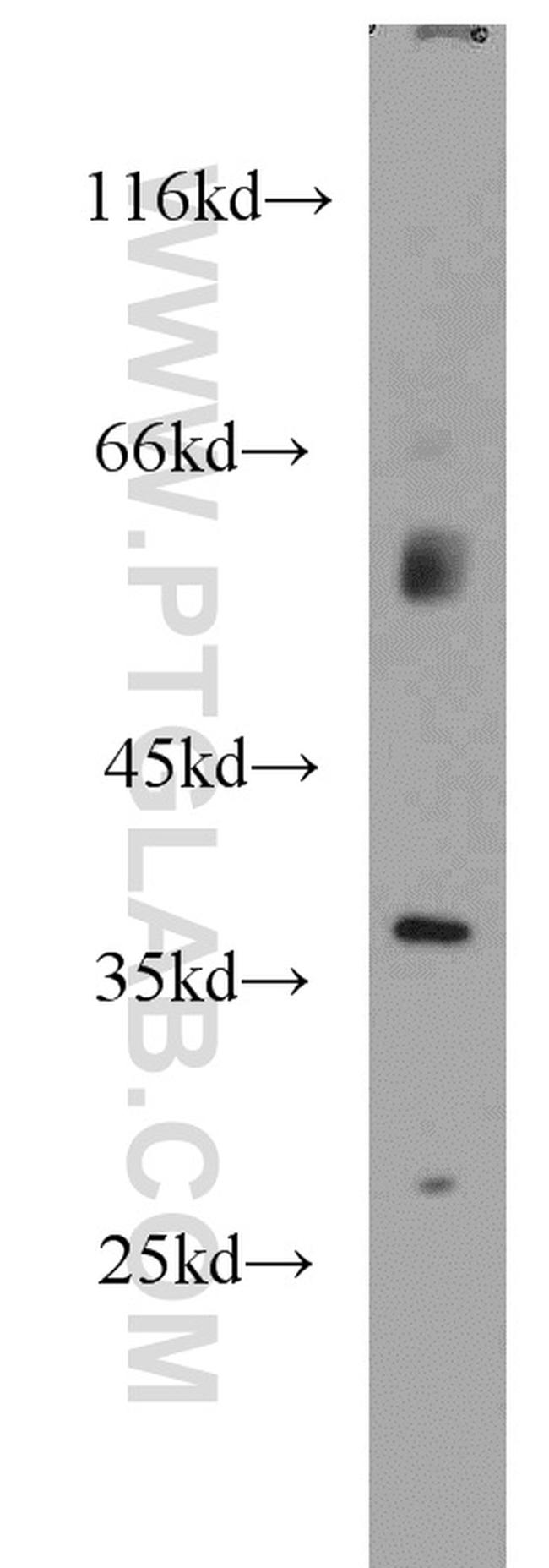 AIP/ARA9 Antibody in Western Blot (WB)