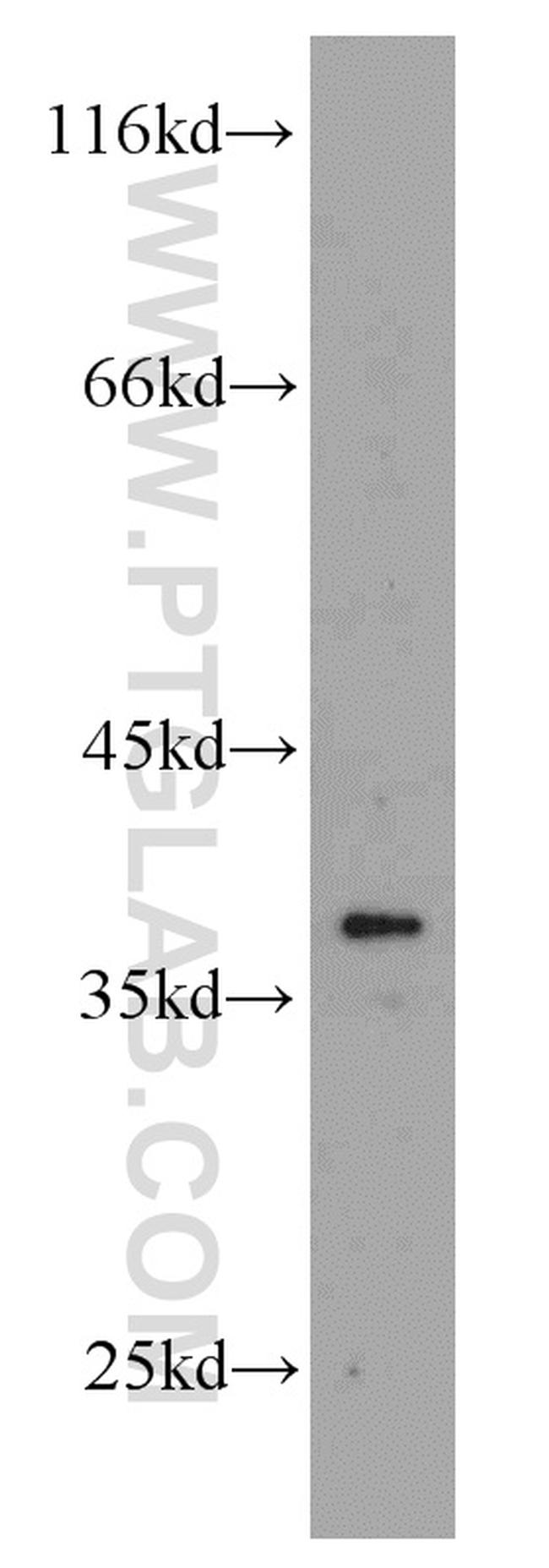 AIP/ARA9 Antibody in Western Blot (WB)